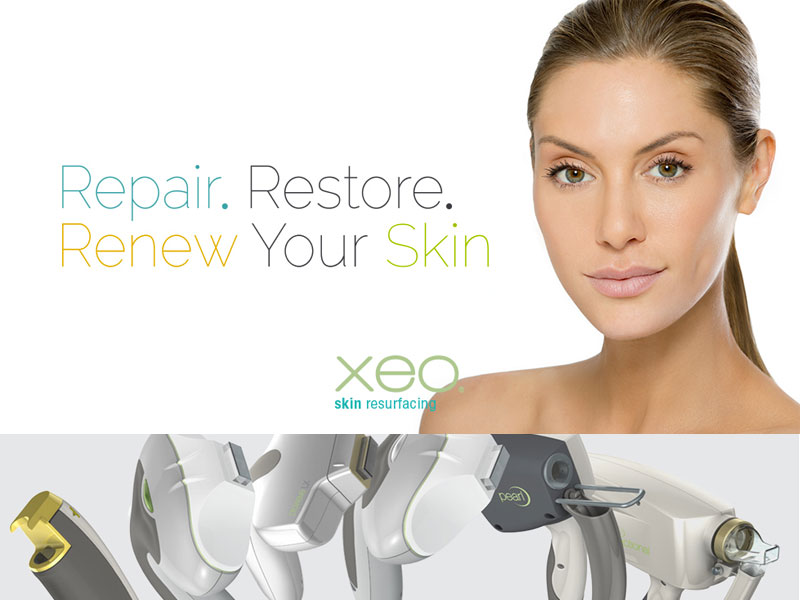 laser skin treatment clinic bolton