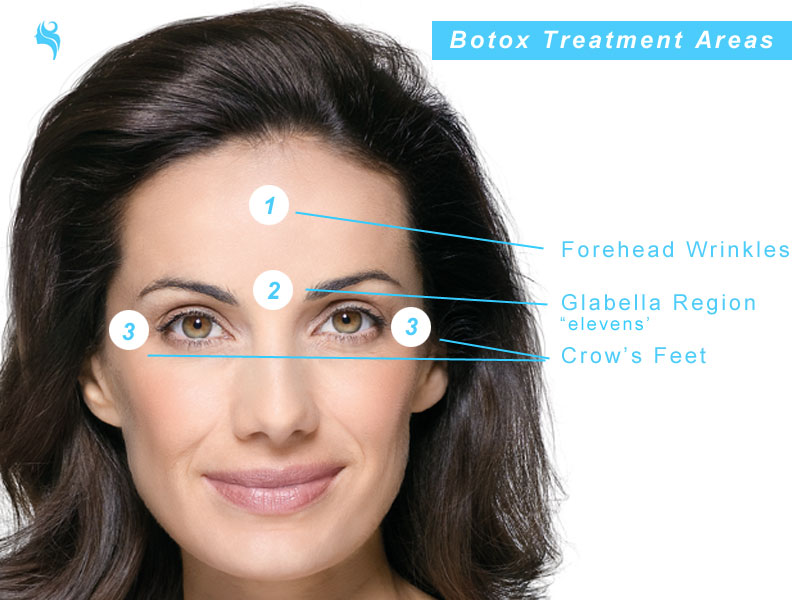 dermal fillers treatment areas