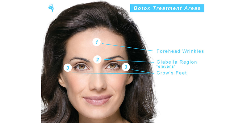 Glabella Treatments