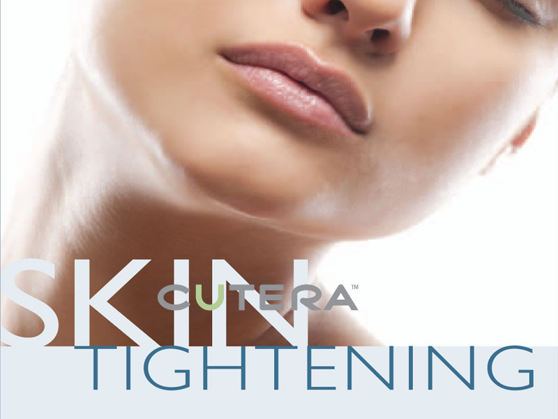 Cutera laser titan tightening skin